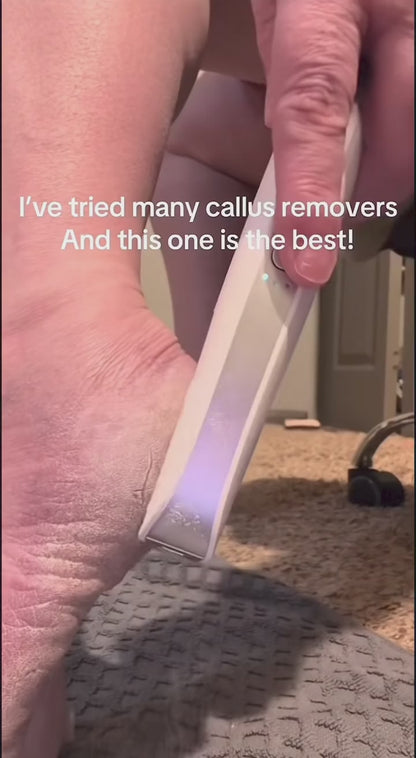 Electric Callus Remover